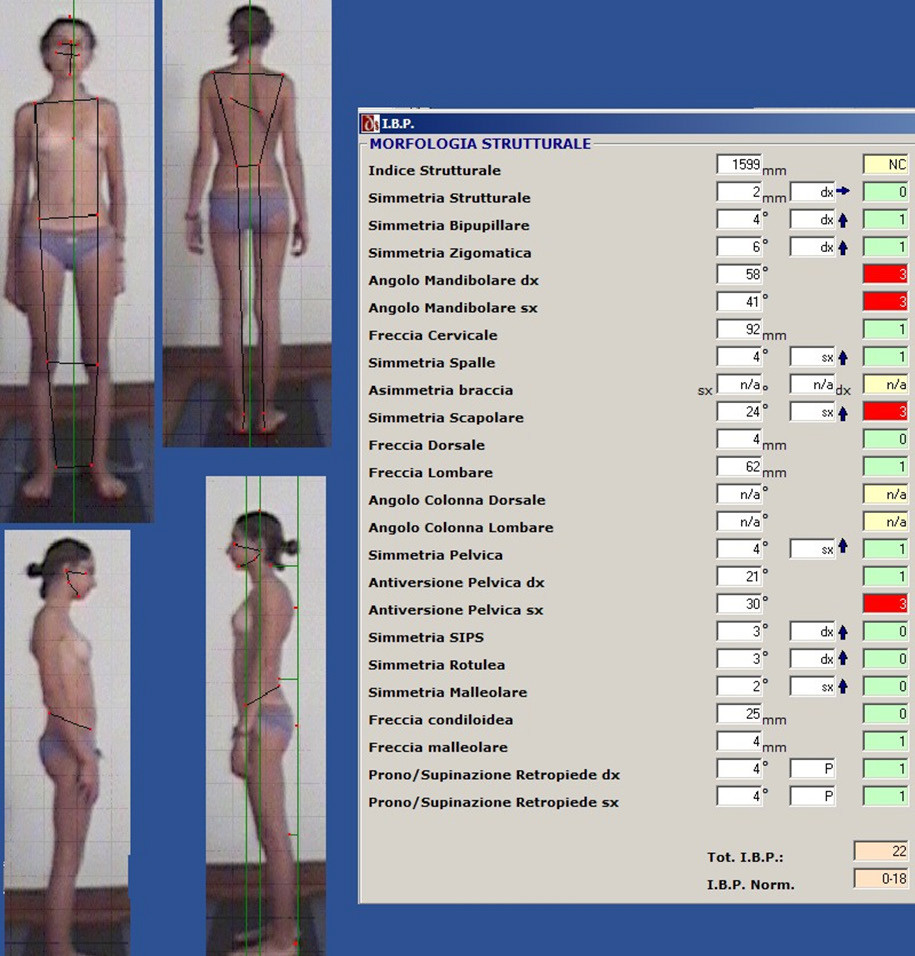 indice biometrico posturale