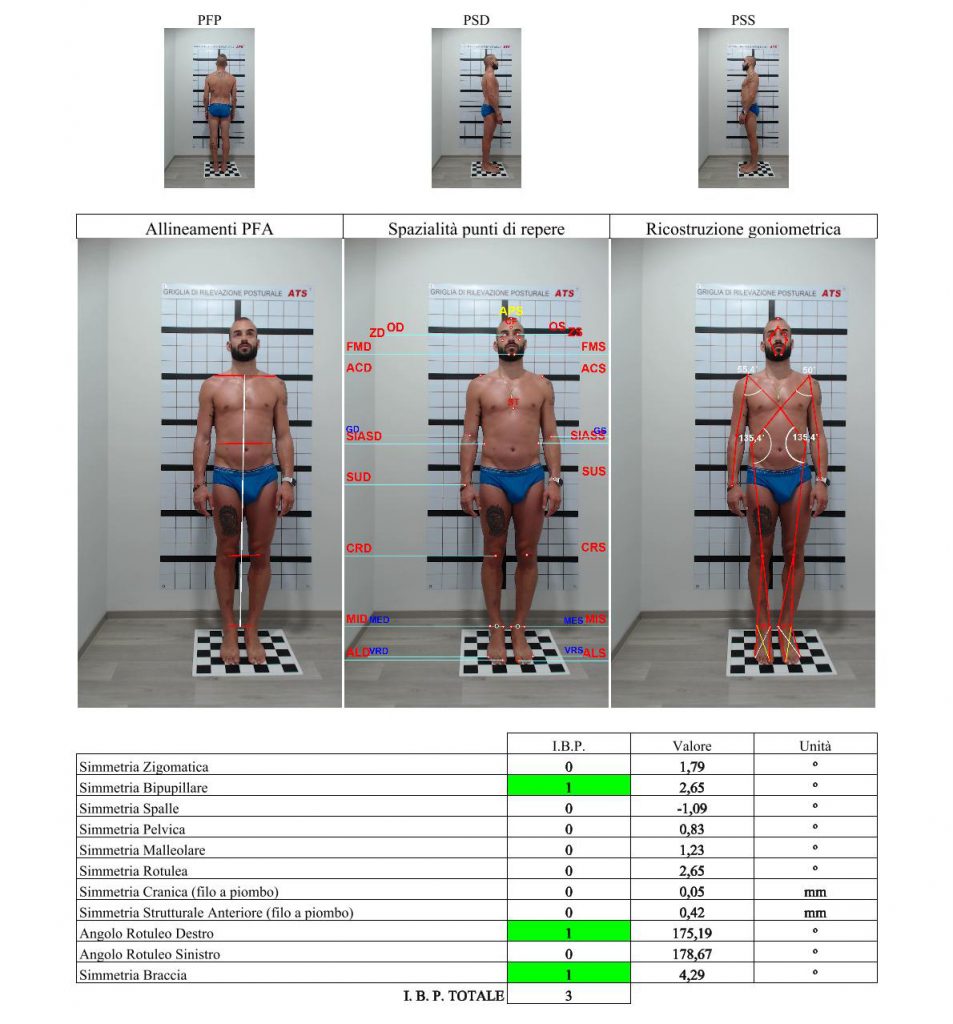 ricostruzione analisi posturale 3d bak
