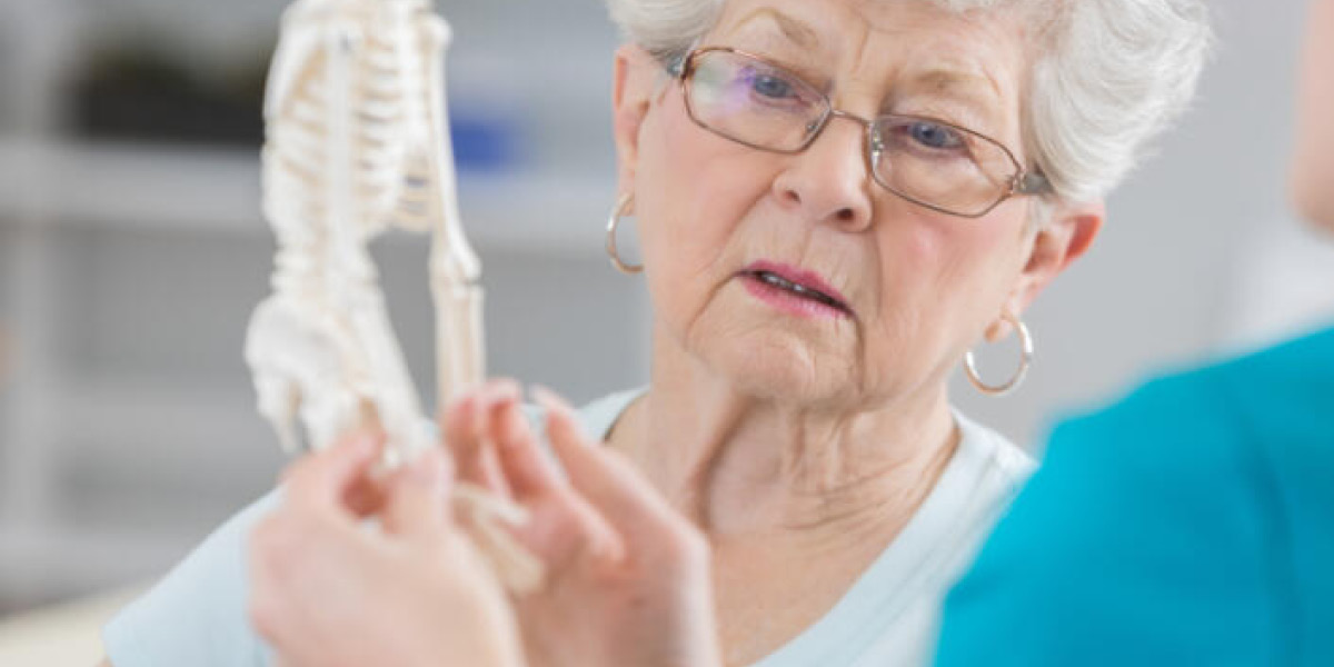 osso centro osteoporosi medical group italia