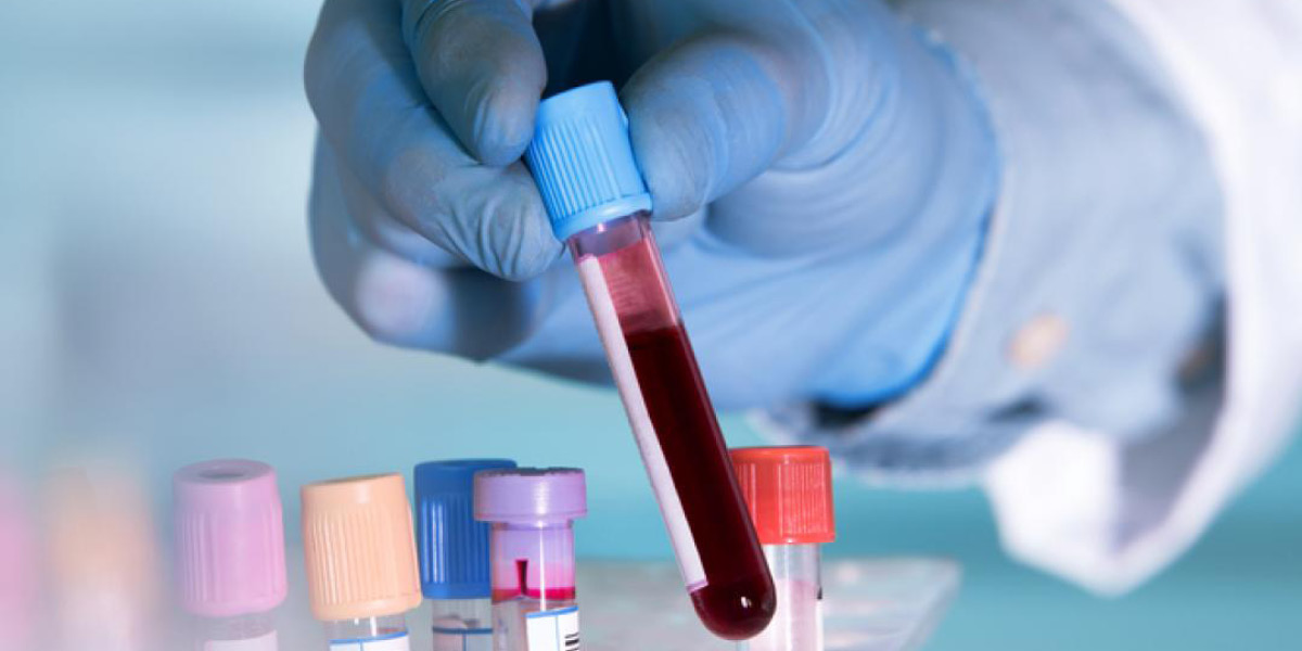 sangue laboratorio analisi medical group italia