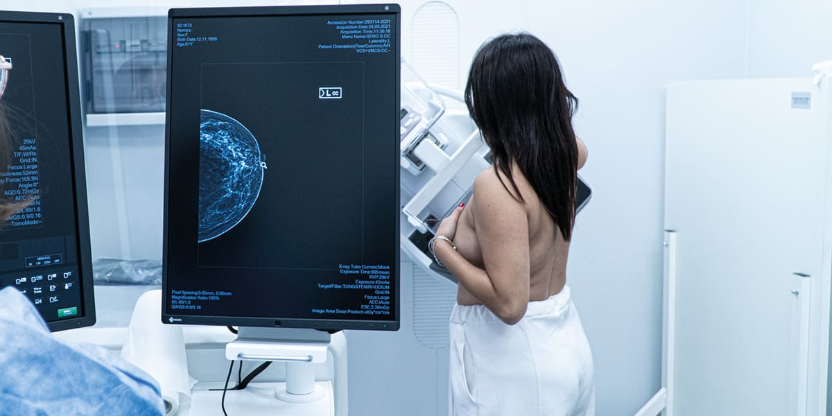 seno mammografia 2d 3d con tomosintesi medical group italia