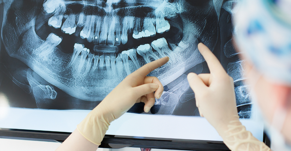 RX Arcata Dentaria Inferiore Medical Group - Formato Foto Testo