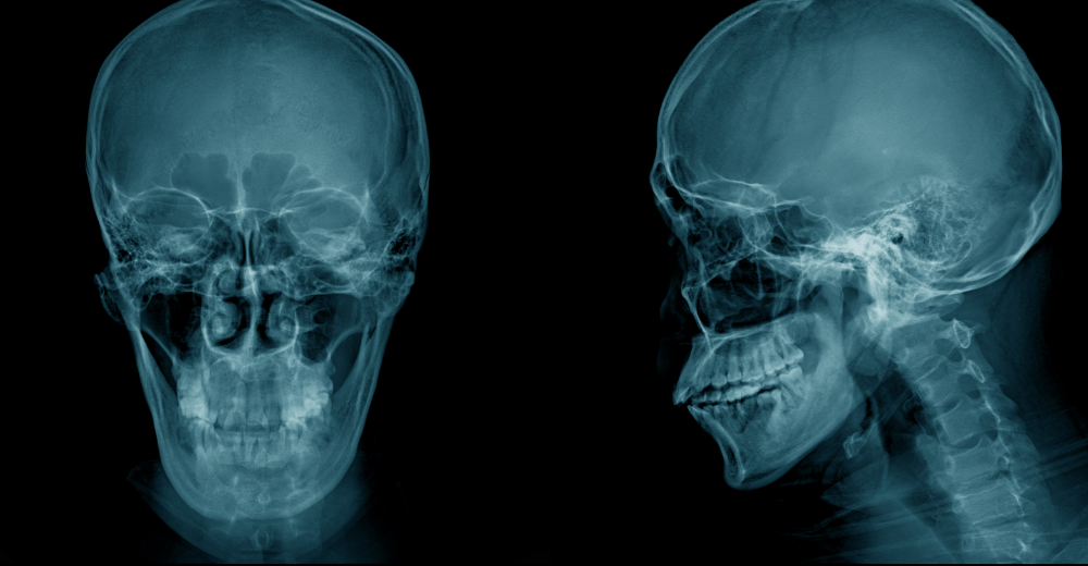RX Cranio e Seni Paranasali Medical Group - Formato Foto Testo