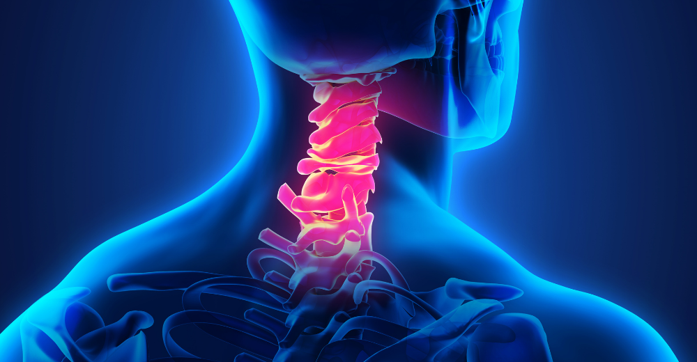 Risonanza Magnetica Cervicale Medical Group - Formato Foto Testo