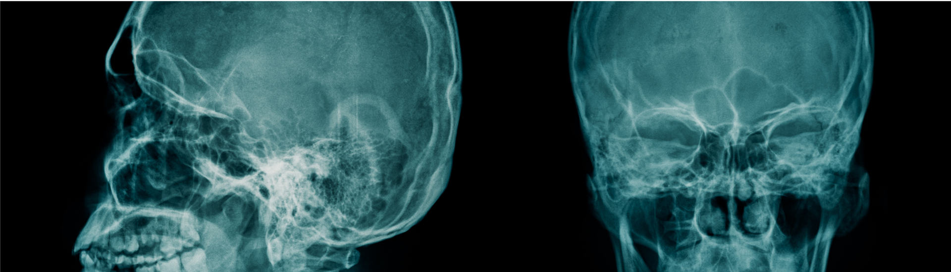 Teleradiografia Cranio per Cefalometria Medical Group - Formato Desktop