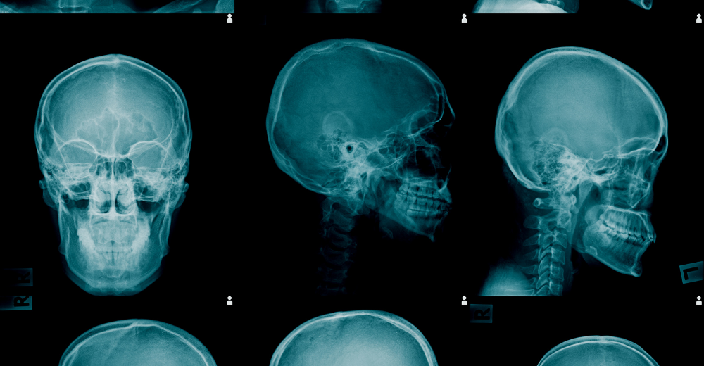 Teleradiografia Cranio per Cefalometria Medical Group - Formato Foto Testo