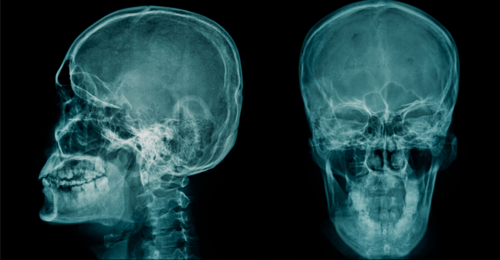 Teleradiografia Cranio per Cefalometria Medical Group - Formato Mobile