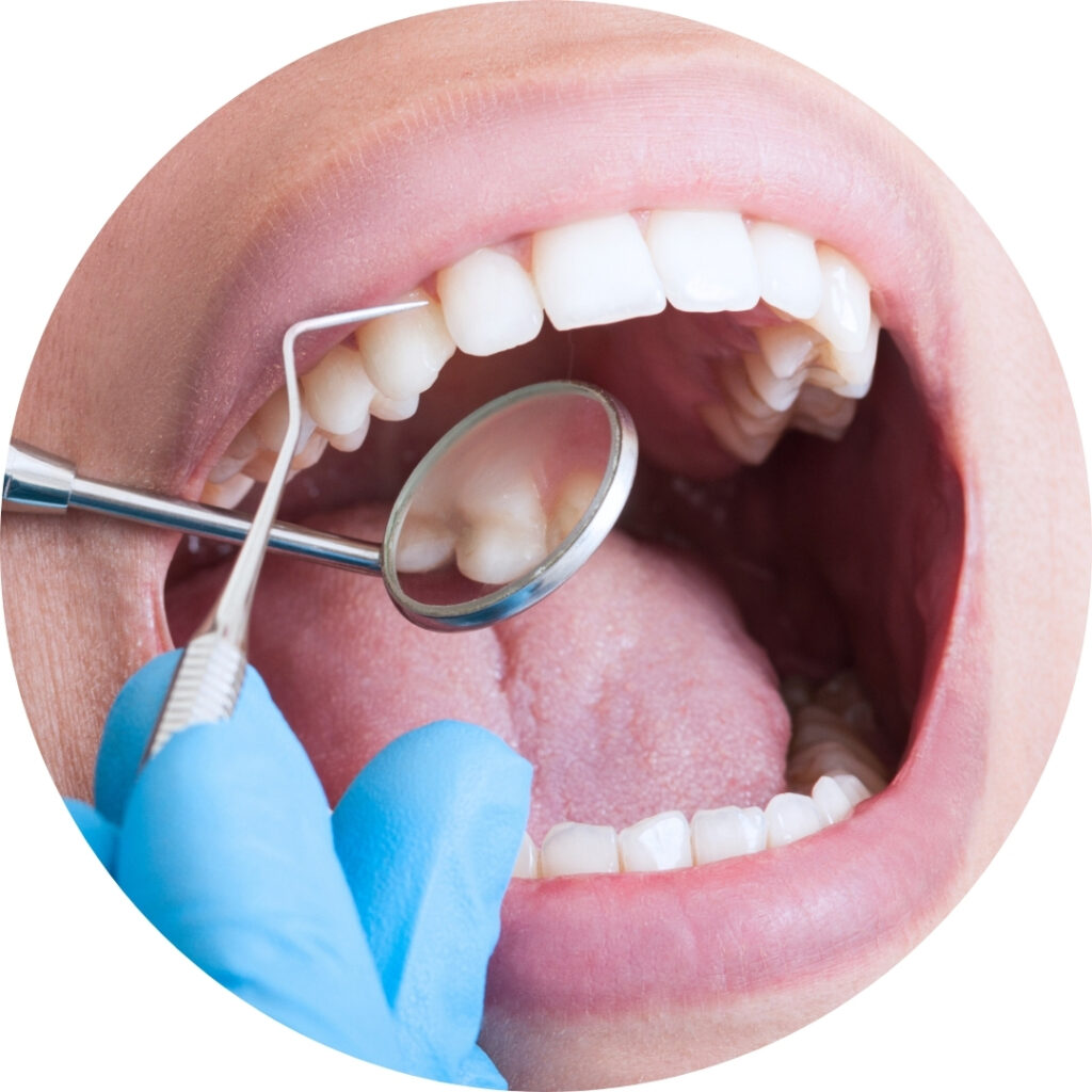 Immagini-Landing-icona-DIAGNOSTICA-DENTALE